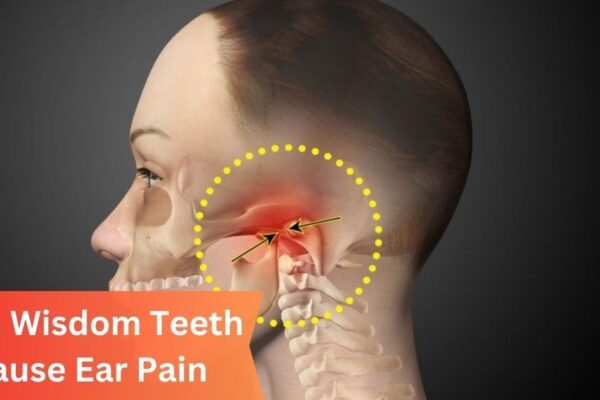 Can Wisdom Teeth Cause Ear Pain